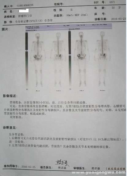 16年5月骨扫描