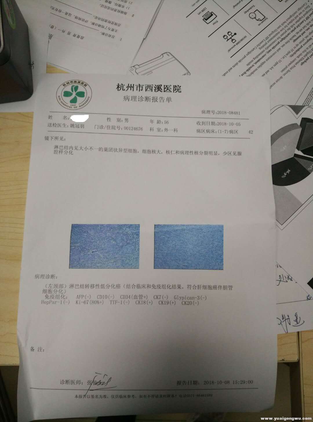 淋巴活检病理报告